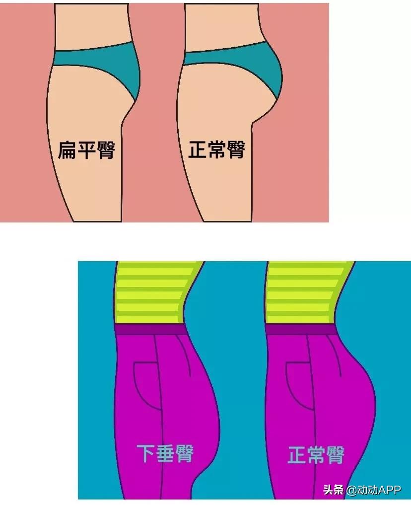 瘦假胯臀最快的方法,妈妈臀假胯宽臀部凹陷先练哪里
