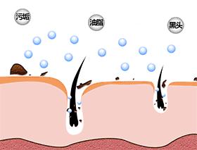 去黑头方法让黑头再也长不出,黑头太顽固教你去黑头的方法