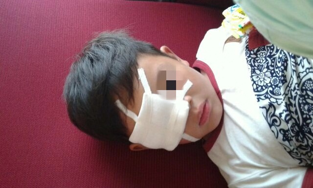 生石灰不慎进入眼睛怎样处理,生石灰不慎入眼现场处理方法