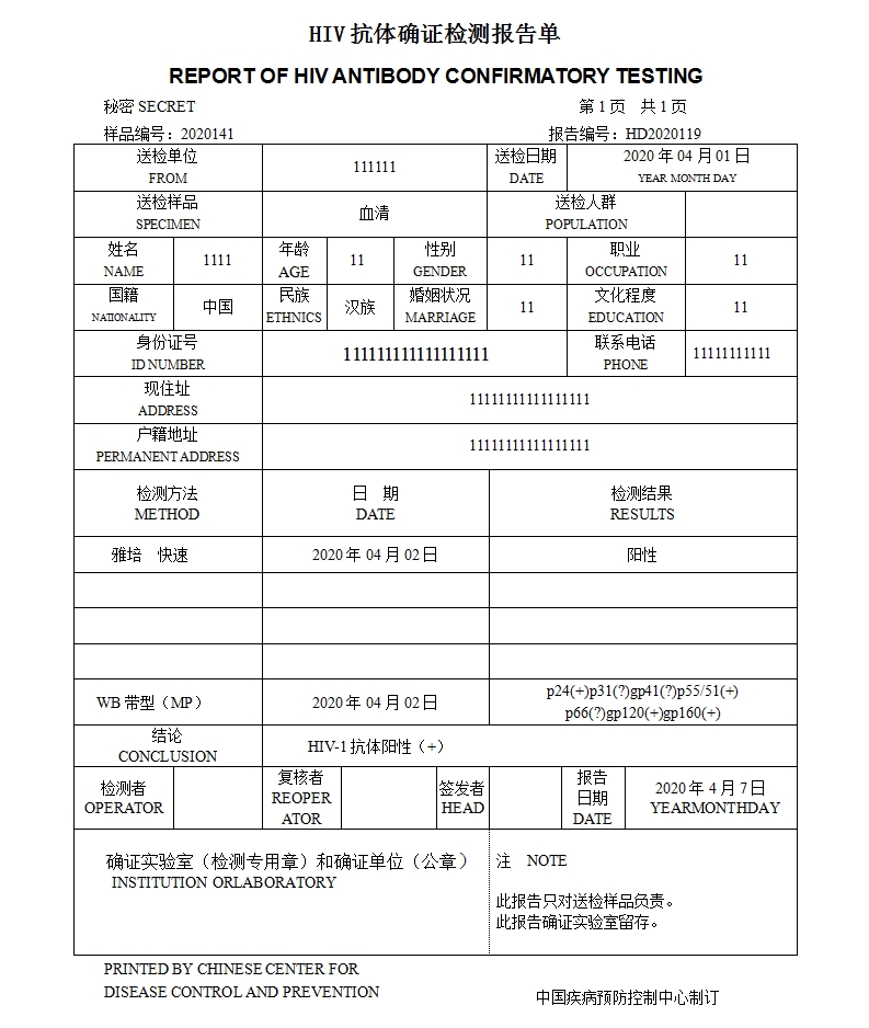 确诊艾滋病之后会不会被隔离,确诊了艾滋病会被隔离吗