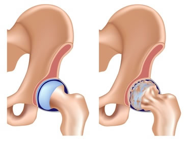 影响人类健康四大慢性病,影响最广的十大疾病