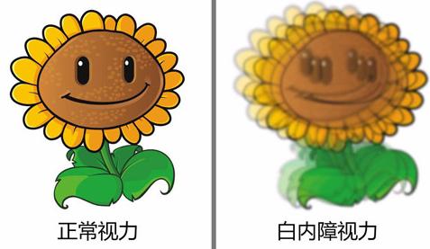 白内障到底是什么!你了解白内障吗?