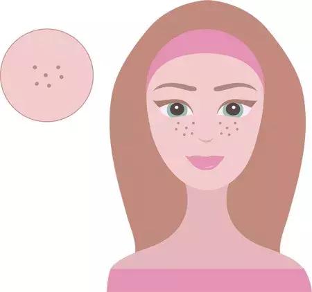 不同的斑不同的治疗方法文案,治疗斑最好的方法