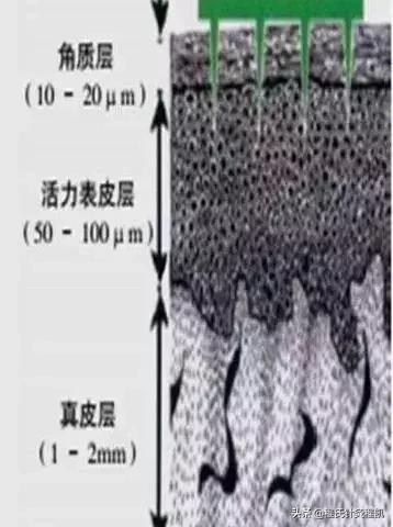 怎么治痘痘痘印最有效的方法,如何治好痘痘痘印最有效