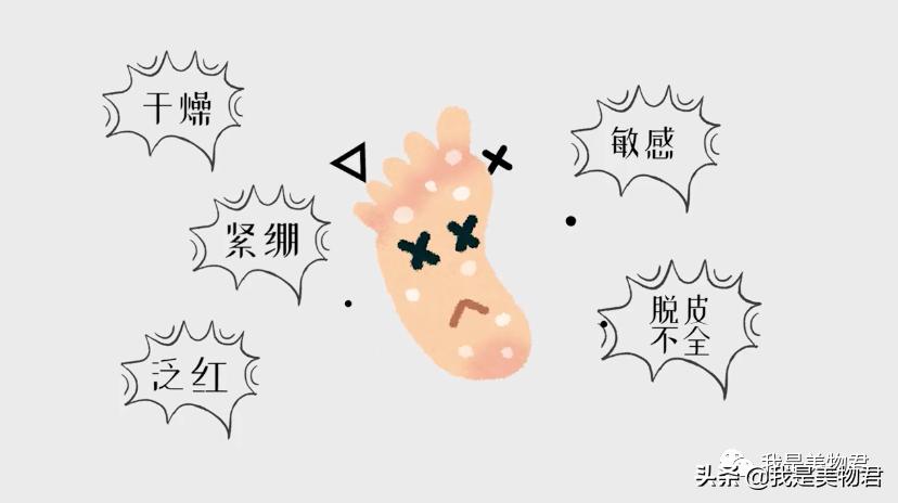 马上又到了穿凉鞋的季节脚部护理,凉鞋脚部护理方法