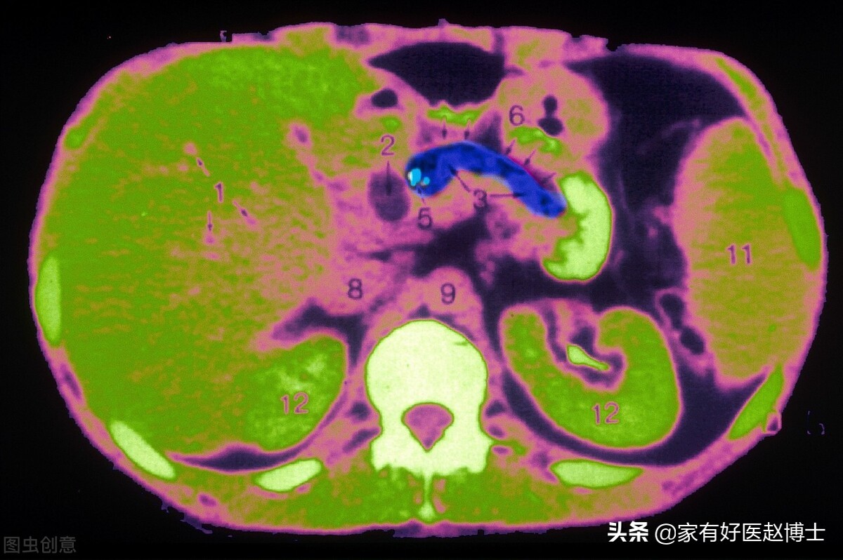 体检报告中常出现钙化哪些需警惕,钙化有什么症状和危害