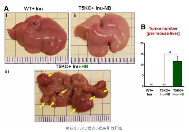 肝癌高发是食品添加剂惹的祸吗,长期吃纤维会得肝癌吗