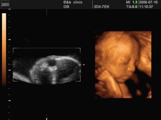 四维彩超预约了还要排队叫号吗,做四维什么时候预约合适