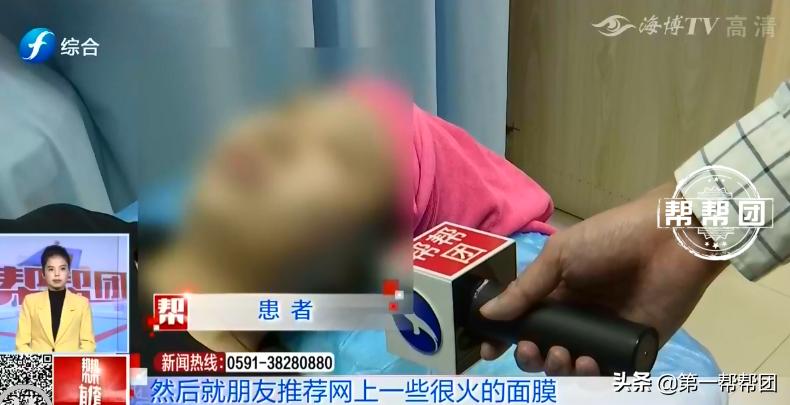 用了面膜皮肤变黑又脱皮,网红面膜变成激素皮炎