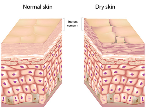 玉泽能修复角质层吗,角质层修复最快方法