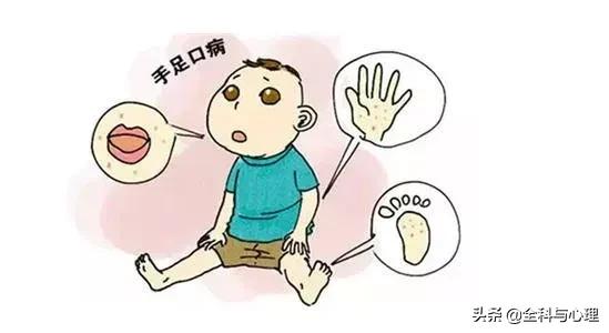 预防水痘手足口病等传染病,春季水痘高发季节该如何预防