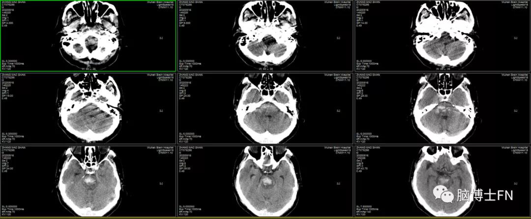 病魔无情人间有爱诗词,病魔无情人间有爱