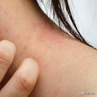 皮肤干燥脱皮10分钟清晨急救法,皮肤干燥尤其是秋冬会全身脱皮