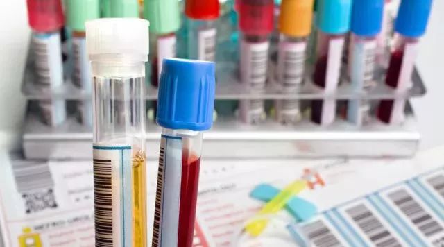 2023清风行动有指标吗,健康体检需要清风计划吗