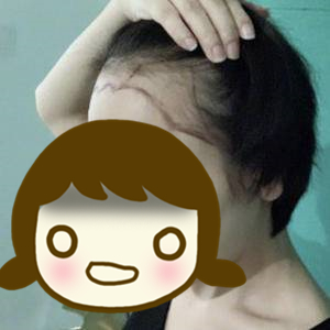 发际线太高怎么办初中生,发际线太高怎么办学生党