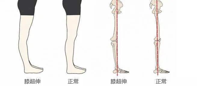 巴西柔术需要柔韧性吗,巴西柔术是技巧还是力量