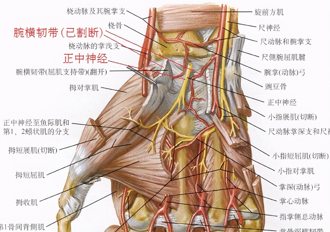 腕管综合征用什么办法诊断,腕管综合征鉴别诊断图片