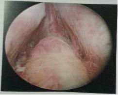 山东治疗泌尿外科比较好的医院,山东大学附属医院泌尿外科专家