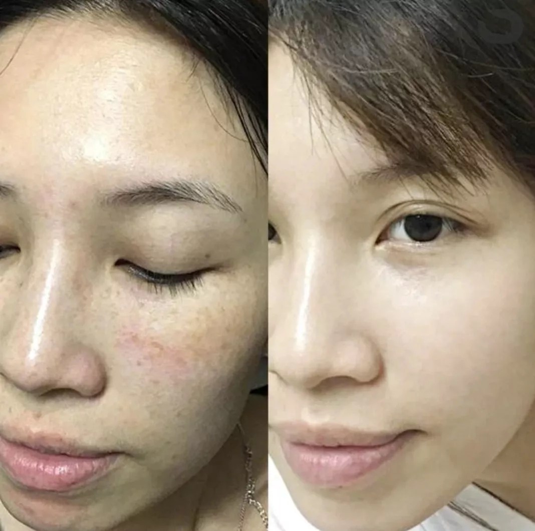 张天爱视频用的保养护肤面霜,张天爱作息曝光视频