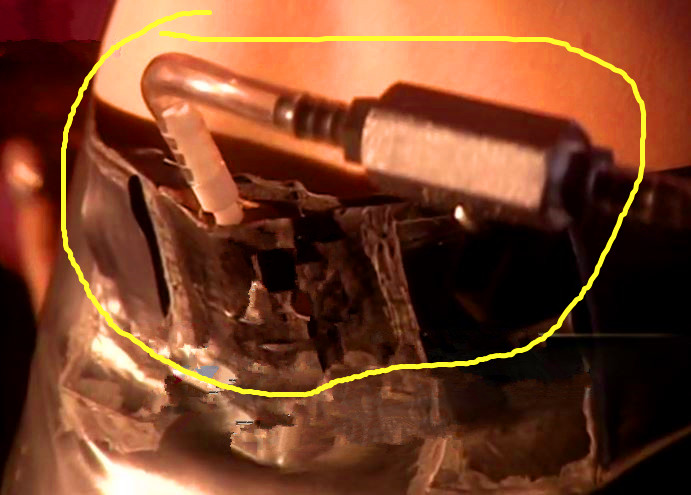 男性和女性排便差异,男性排屁量