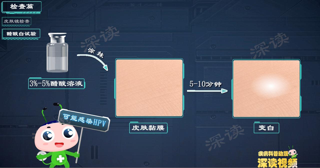 液氮冷冻治疗尖锐疣疼吗 (液氮冷冻治疗尖锐疣几天掉)