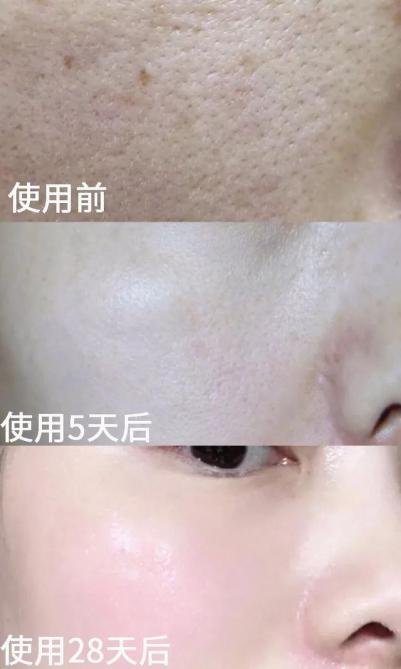 大长今宋慧乔金喜善,大长今金喜善宋慧乔