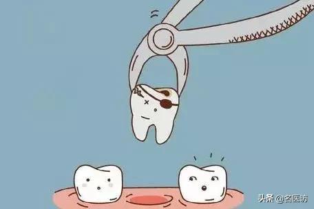 牙齿快烂了是拔还是补,牙齿烂剩下根了怎么拔