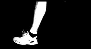 跑步最常见的十种伤痛及处理方法,跑步相关运动损伤综述