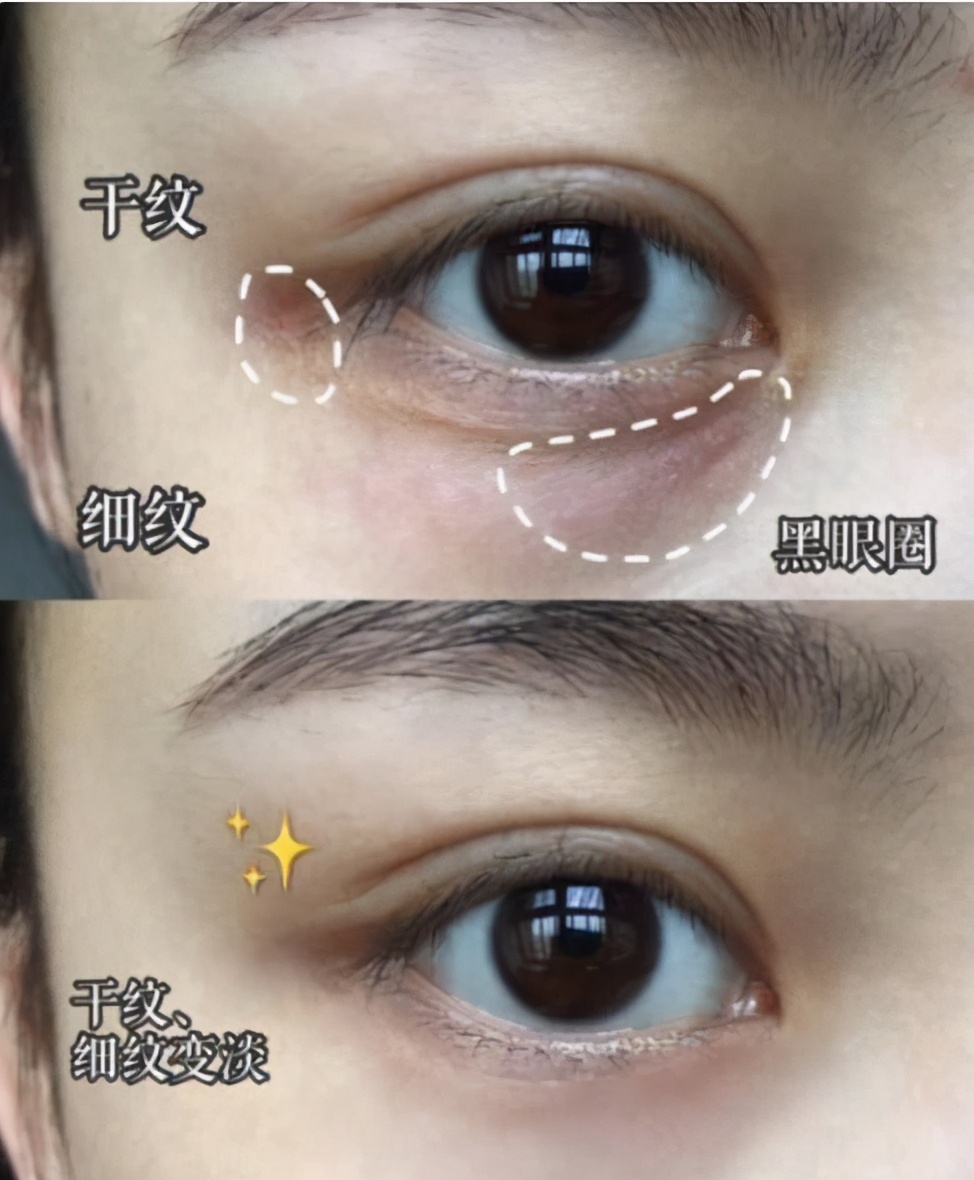 吴昕眼霜哪款最好用了,吴昕beauty推荐眼霜