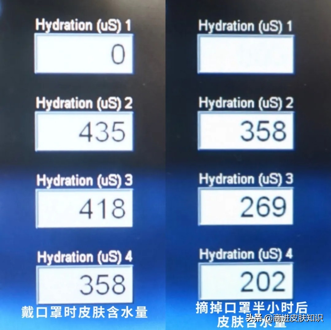 复工的你是否患上“痘痘、干痒及敏感”呢？