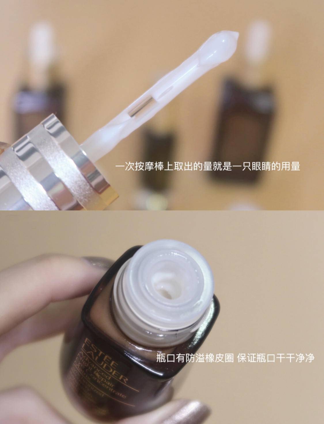 眼周水肿的原因分析,如何改善眼皮浮肿