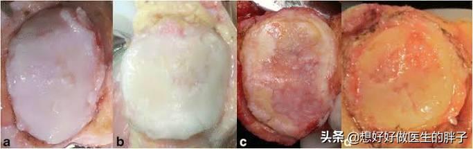 骑自行车膝关节酸是怎么回事,骑自行车时膝盖疼是怎么回事