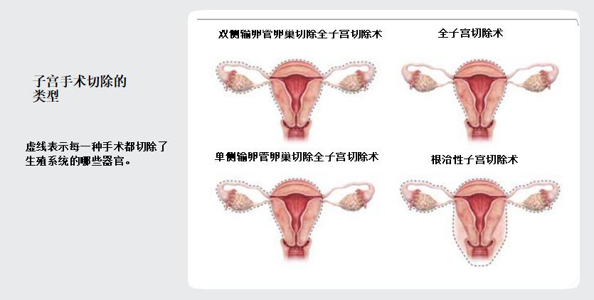 谈癌色变属于条件反射吗,谈癌色变怎么解释