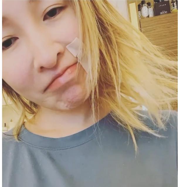 萧亚轩被狗咬伤能回到以前吗,萧亚轩被狗咬伤视频