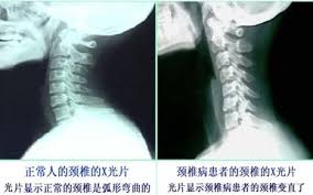 除了中药还有什么办法治失眠,月经量少失眠挂什么中医科