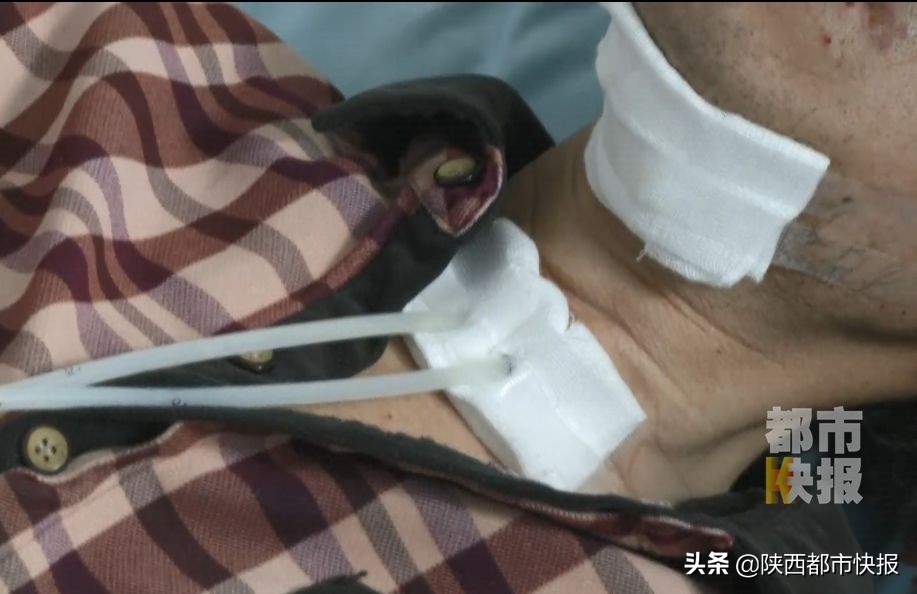 男子牙疼出脓液,男子牙疼去医院检查发现虫子