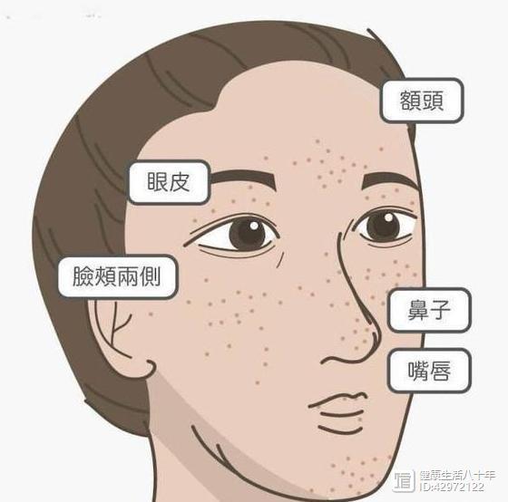 肝脏开始病变会有哪些症状,肝脏病变会有什么症状