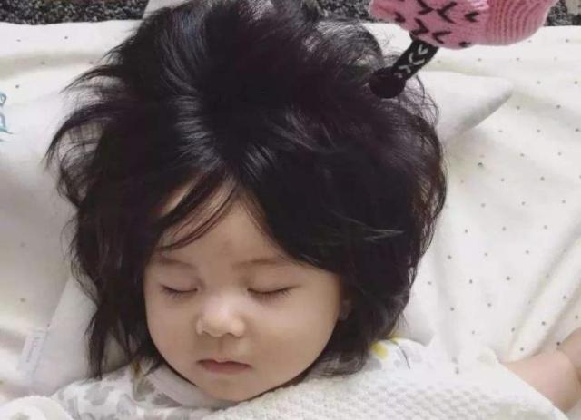 宝宝头发稀少原因及解决方法,头发有的地方浓密有的地方稀疏