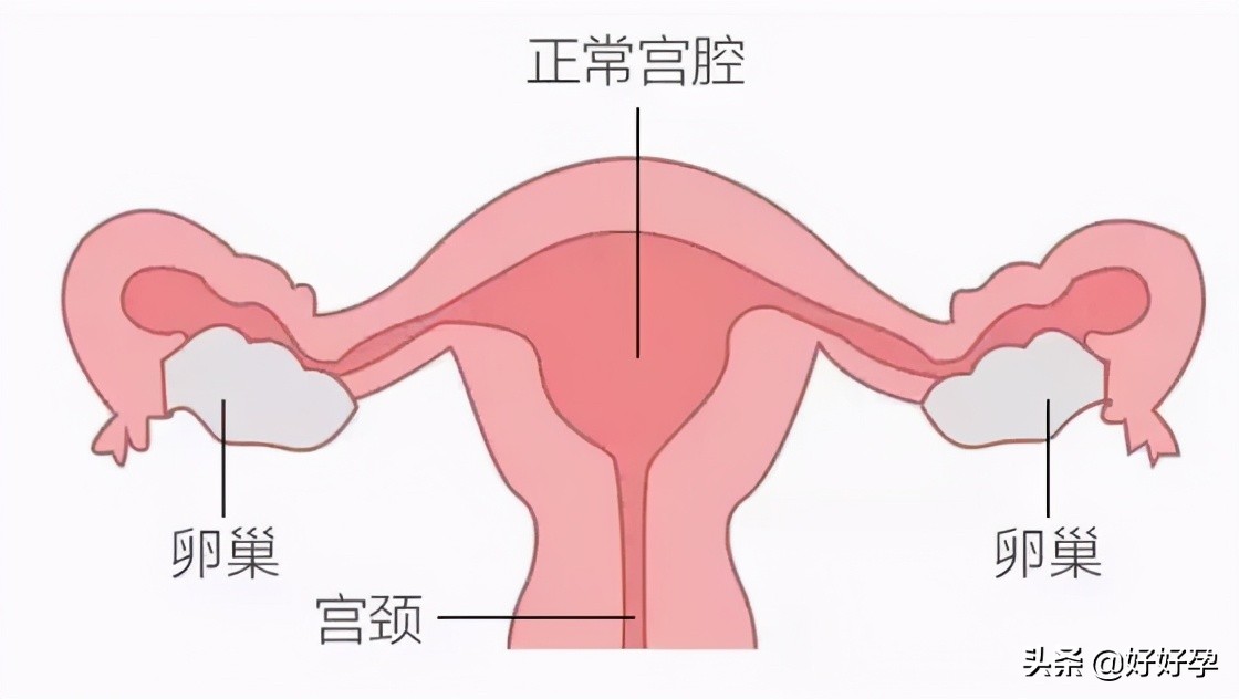 啪啪不戴套，26岁姑娘子宫“一团乱麻”……还能好好生娃吗？