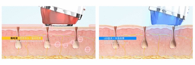 杨幂做了什么医美,杨幂新氧医美