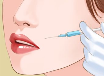 法令纹怎样淡化效果最好,法令纹淡化最有效的方法