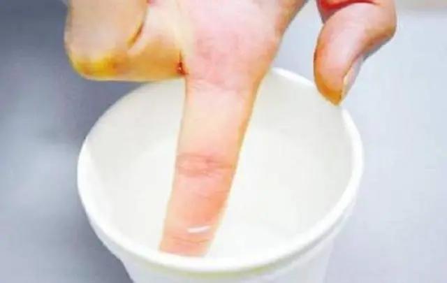 手上粘了502胶水怎样快速去除,如何快速去掉粘在手上的502胶水