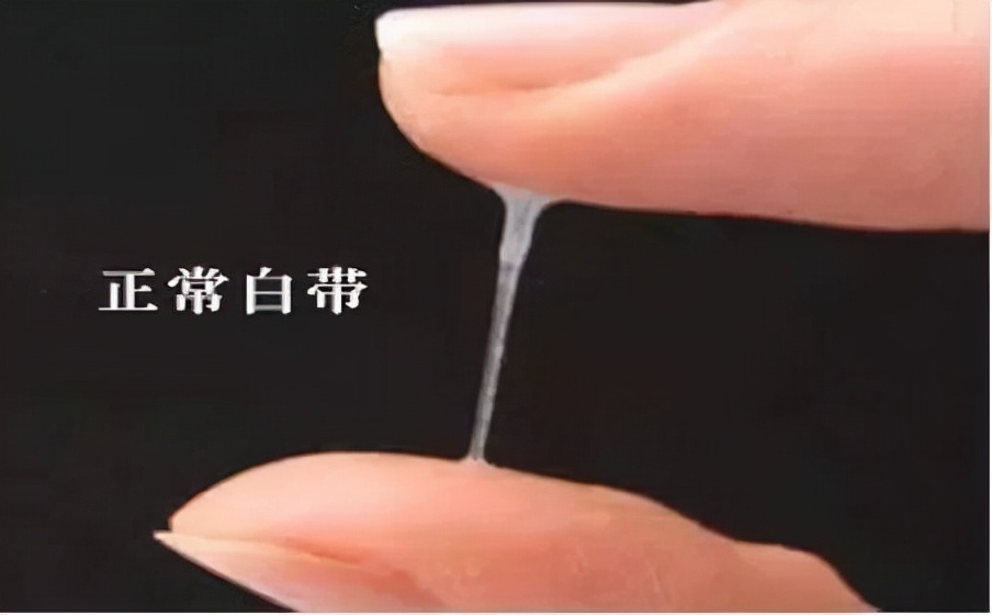 为什么女生的*裤内**里总是有一层“黄黄”的分泌物？正常吗？