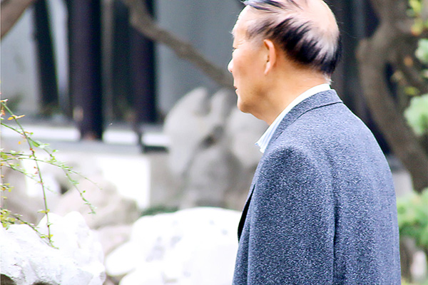 如何预防老人不长老年斑,为什么还不到四十岁就长老年斑