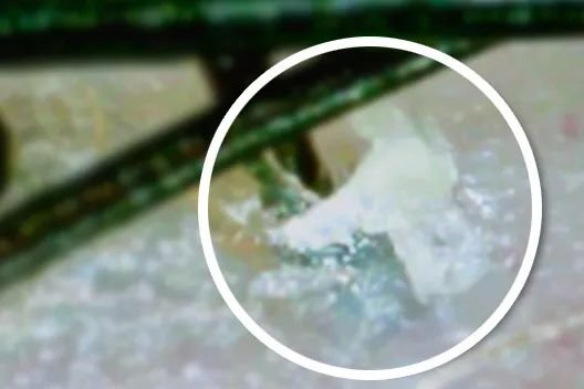 叹头部SPA！拒做人间“油”物，解锁防秃养发小妙招