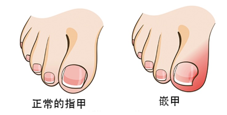 宝宝的鞋子怎么选不伤脚,宝宝的鞋怎么穿