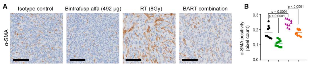 放疗brt,放疗后pd-1防复发