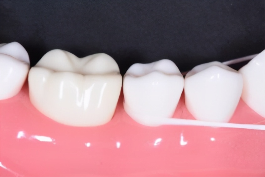 牙周病真实事件,牙周病危害大吗