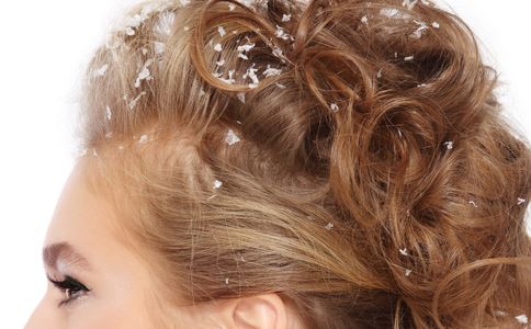 头皮屑最简单的解决方法,头皮屑的原因及解决方法