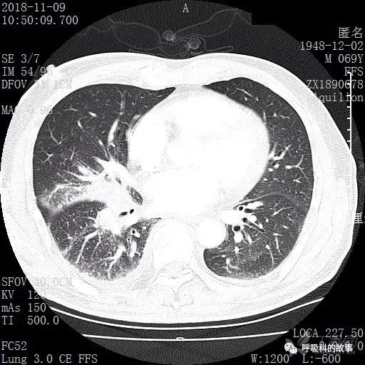 怎么应用统计学做调查,统计学方法可以解决的主要问题